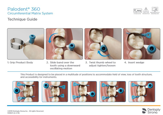 Palodent 360 Circumferential Matrix System